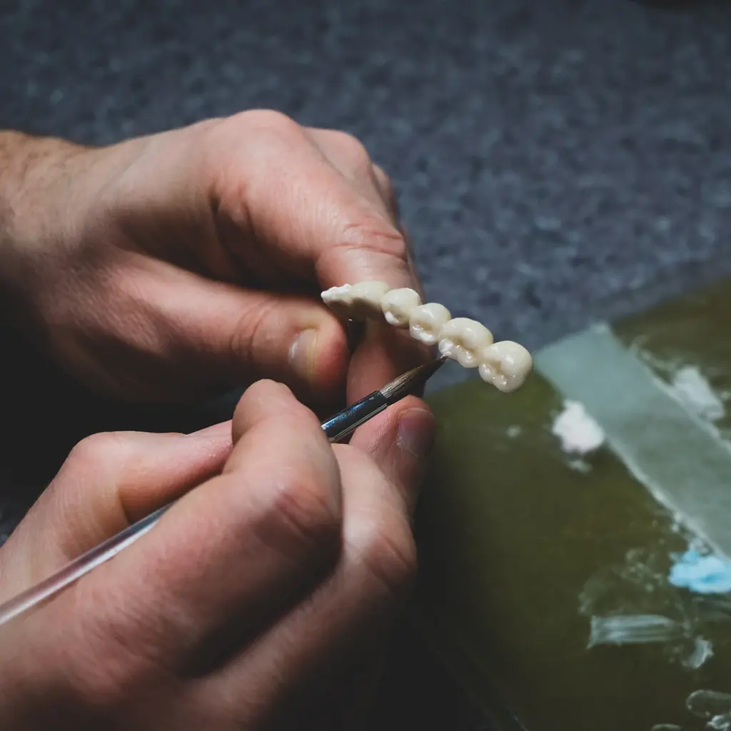 Inlay ve Onlay Dolgu