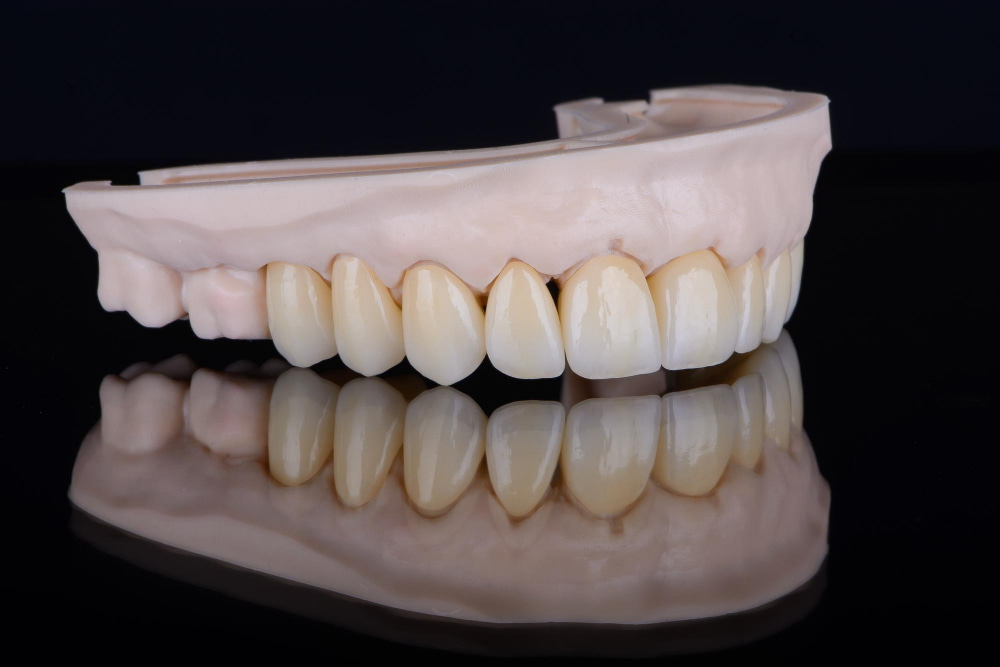 Restoratif Diş Tedavisi Nedir, Nasıl Yapılır?