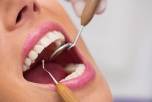 20’lik Diş Hangi Durumlarda Çekilmeli?