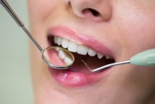 Ayrık Diş Tedavisi Nedir? Nasıl Yapılır?