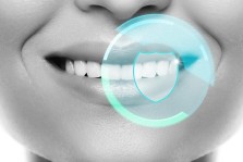 Diş Şeffaflaşması Nedir, Nasıl Geçer?