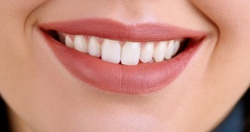 Hollywood Smile (Hollywood Gülüşü) Nedir?